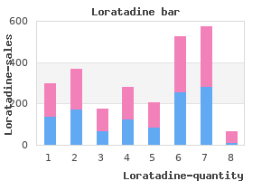 cheap loratadine line