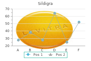 buy cheap sildigra 25mg online